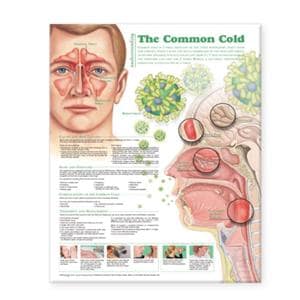 Understanding The Common Cold 20x26" Educational Chart Ea