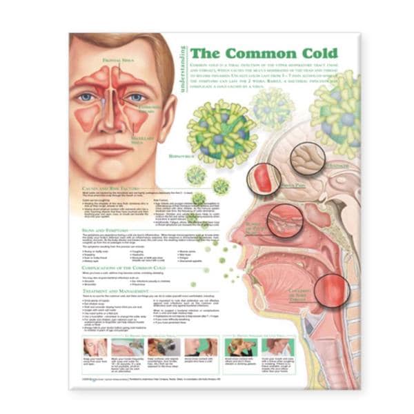 Understanding The Common Cold 20x26" Educational Chart Ea