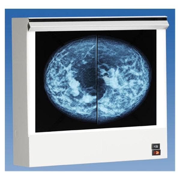 VuPlus Mammography Viewer Ea