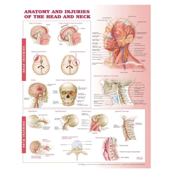 Anatomy and Injuries of the Head and Neck 20x26" Anatomical Chart Ea