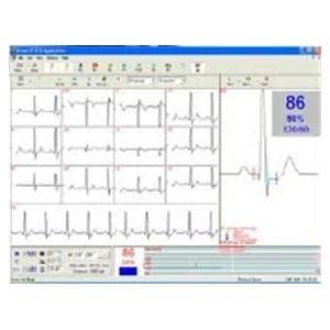 Software Interpretation New For EKG Ea