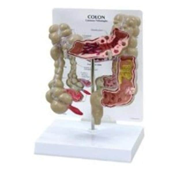 GPI Anatomicals Colon Model Ea