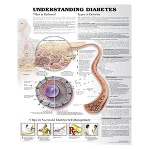 Understanding Diabetes 20x26" Educational Chart Ea