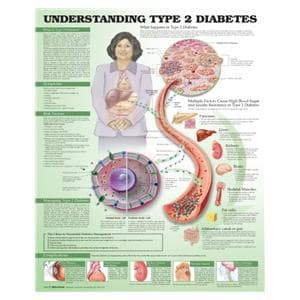 Understanding Type 2 Diabetes 20x26" Educational Chart Ea