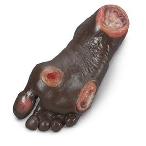 Foot Pressure Ulcer Anatomical Elderly Model Ea