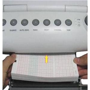 Recording Paper New For F9 Fetal Monitor 90x152mm 3/Pk