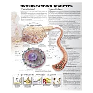 Understanding Diabetes Educational Chart Ea