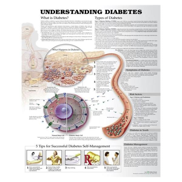 Understanding Diabetes Educational Chart Ea