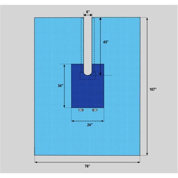 76x107" Sterile Sheet Drape