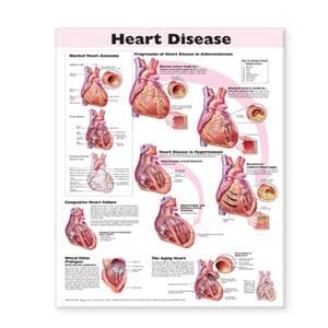 Heart Disease 20x26" Educational Poster Ea