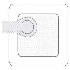 Pico 7 Negative Pressure Wound Dressing 15x15cm Strl Sqr Wht Kt Single Use 3/Ca