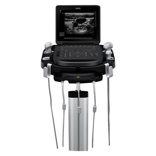 Sonosite Edge II Portable Ultrasound Reconditioned w/ Trnsdcr / POS Wrnty Ea