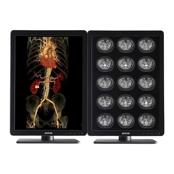 3MP Nio Monitor Medical Color LCD With Glass Ea