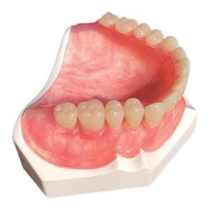 TCS Karadent Karadent Full Denture Marketing Tool Ea