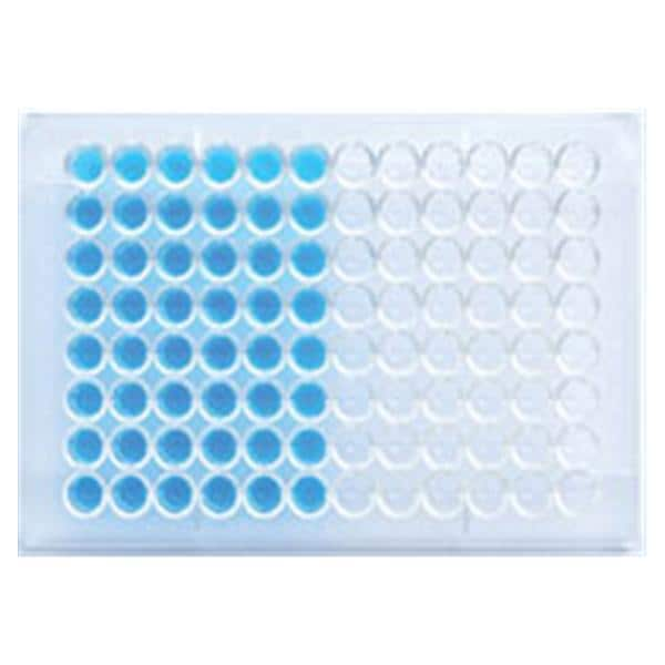 ELISA Schistosoma Mansoni IgG Test Kit Ea