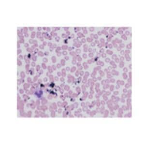 Giemsa Stain 32oz 1/Ca