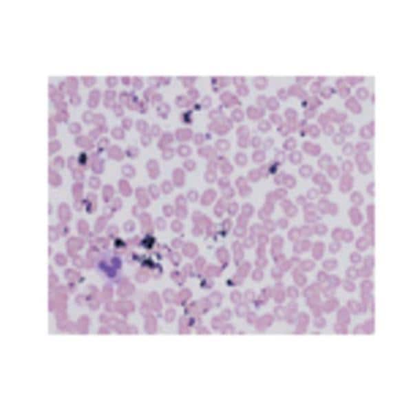 Giemsa Stain 32oz 1/Ca