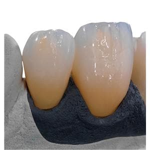 Ceramill Zolid FX Zirconia Disc White 98x18 Ea