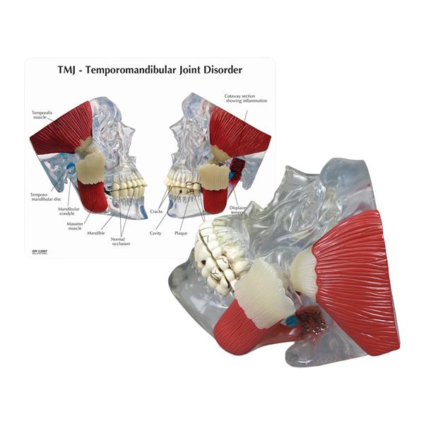 Patient Education Model TMJ Skull 6 in x 6 in x 6.5 in Ea