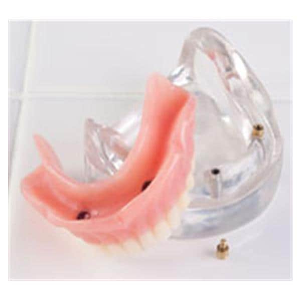 Over-Denture Locator Model LOC-2 Lower Ea