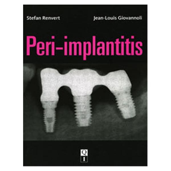 Book Peri-Implantitis Ea