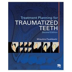 Book Treatment Planning for Traumatized Teeth 2nd Edition Ea