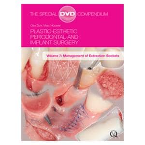 DVD Plstc-Esth Perio And Implnt Surg: Mgt of Ext Sockets Volume 7 Ea