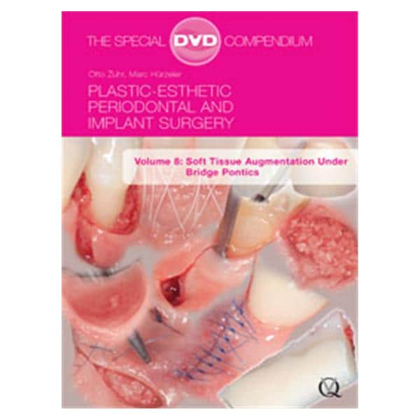 DVD Plastic-Esthetic Perio Imp Volume 8 Ea