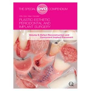 DVD Defect Reconstruction Volume 9 Ea