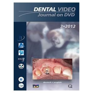 DVD Dental Video Journal on DVD: 03/2012 Ea