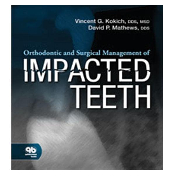 Book Orthodontic and Surgical Management of Impacted Teeth Ea