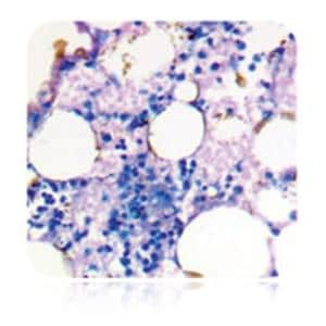 May-Grunwald Giemsa Stain Kit Ea