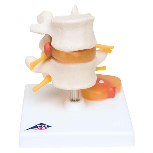 Lumbar Vertebral Column Anatomical Model Each