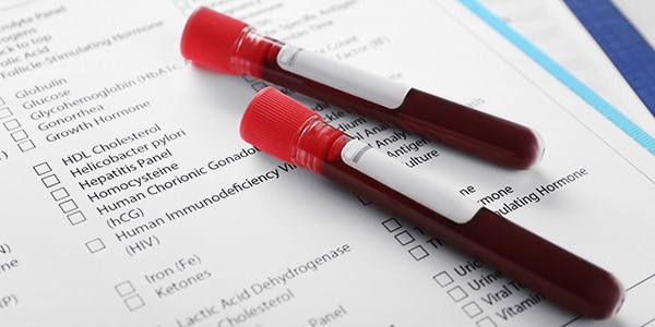 Rapid Diagnostic Tests and Point-of-Care Testing