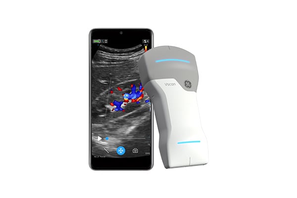 Portable Handheld Ultrasound: Vscan Air™ Ultrasound Machine