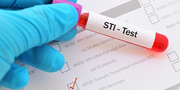 Rapid STI Testing Kits