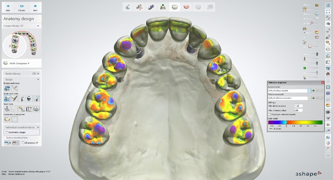 3Shape-Dental-System-2024_image-01