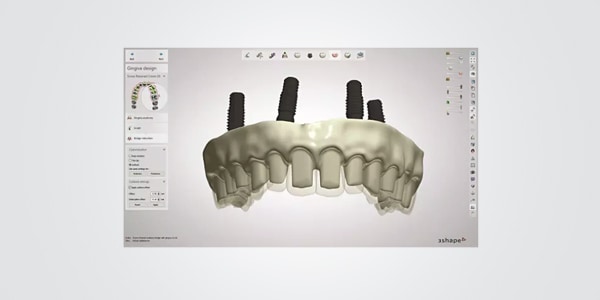 Dental System Crown & Bridge