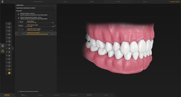 inLab CAD Software - Zahn Dental Labs