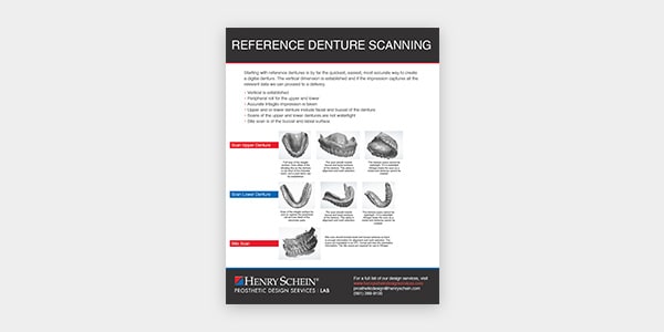 Reference Denture Scanning