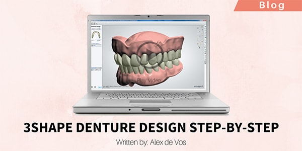 3Shape Denture Design Step-by-step