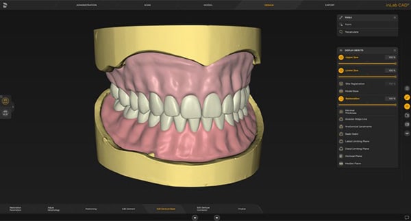 inLab CAD Software - Zahn Dental Labs